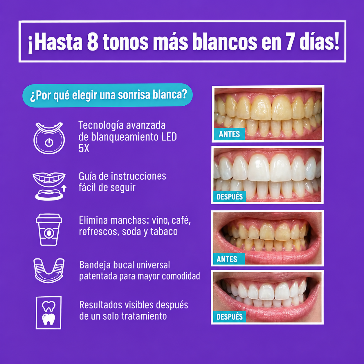 Kit de blanqueamiento dental, profesional