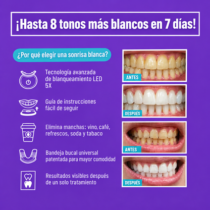 Kit de blanqueamiento dental, profesional